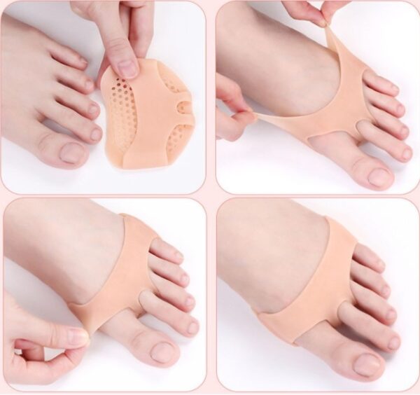 Orta Parmağa Geçen Metatarsal Pad